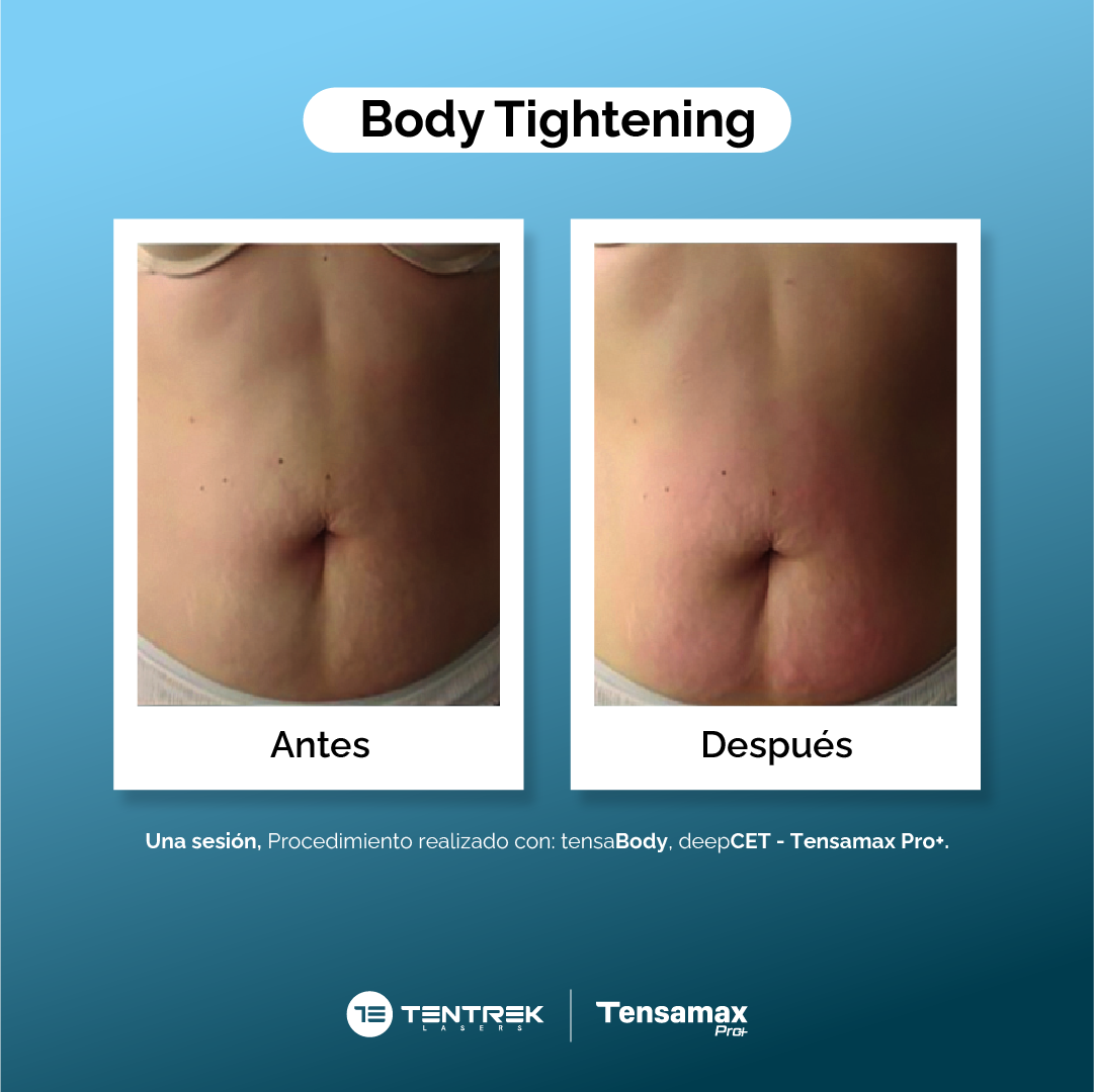 Body Tightening Abdomen